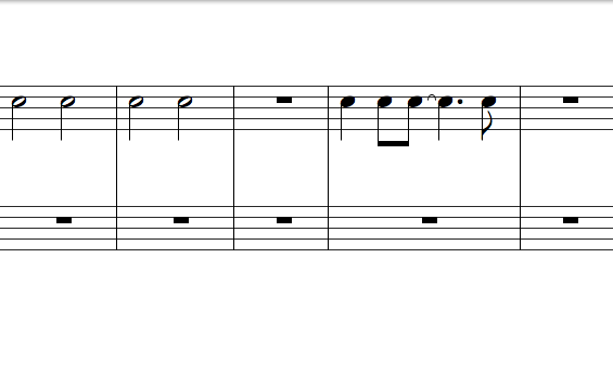 五線譜-節奏類型變化